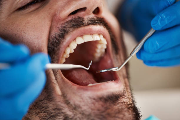 Best Dentist for Severe Toothache  in Cliffside Park, NJ