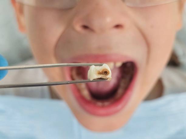 Best Emergency Dentist for Kids  in Cliffside Park, NJ